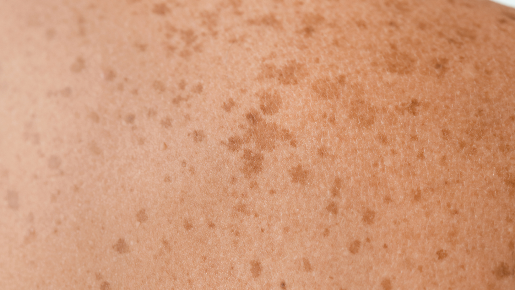 REVIでしわシミスキンケア